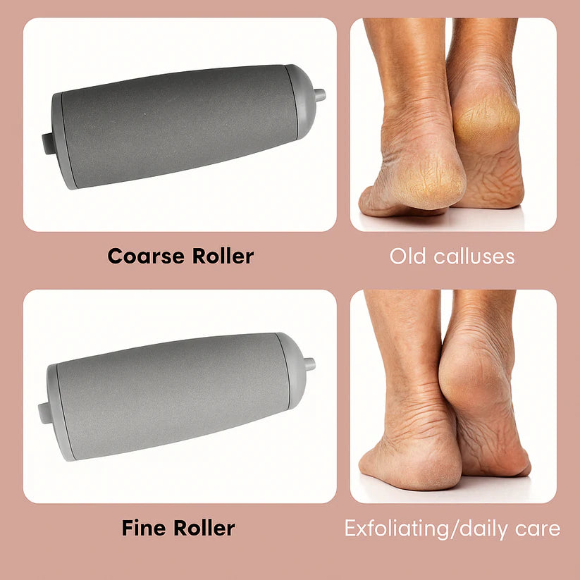 Foot Callus Remover